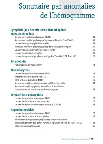 Cytologie des hémopathies malignes. Anomalies sanguines et médullaires