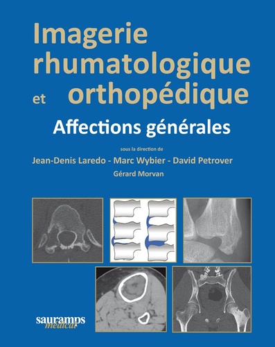Jean-Denis Laredo et David Petrover - Imagerie rhumatologique et orthopédique - Tome 1, Affections générales.
