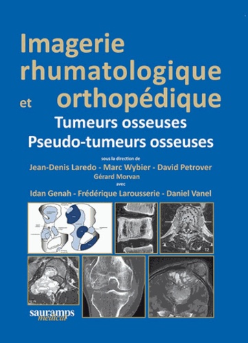 Jean-Denis Laredo et Marc Wybier - Imagerie rhumatologique et orthopédique - Tome 4, Tumeurs osseuses ; Pseudo-tumeurs osseuses.