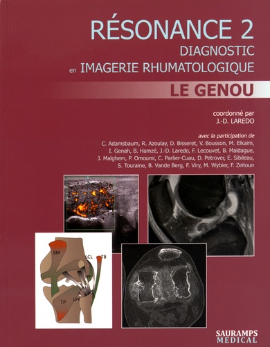 Jean-Denis Laredo - Résonance - Diagnostic en imagerie rhumatologique Tome 2, Le genou.