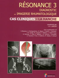 Résonance