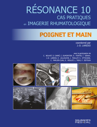 Jean-Denis Laredo - Résonance - Tome 10, Cas pratiques en imagerie rhumatologique : poignet et main.