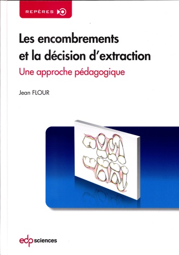 Jean Flour - Les encombrements et la décision d'extraction - Une approche pédagogique.