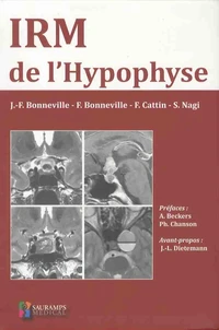 IRM de l'hypophyse