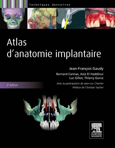 Jean-François Gaudy et Bernard Cannas - Atlas d'anatomie implantaire.