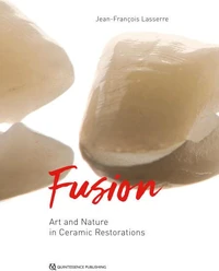 Fusion