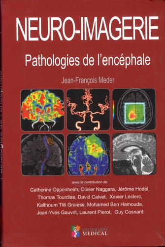 Jean-François Meder - Neuro-imagerie - Pathologies de l'encéphale.