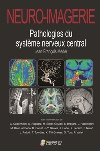 Jean-François Meder - Neuro-imagerie - Pathologies du système nerveux central.