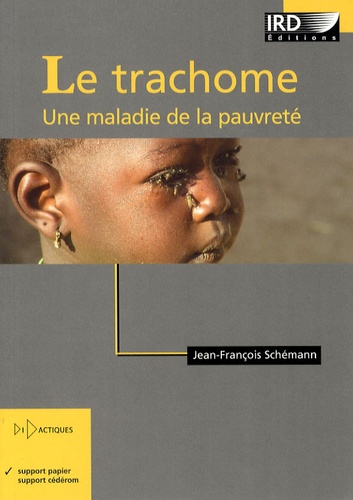Le trachome. Une maladie de la pauvreté