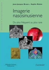 Imagerie nasosinusienne