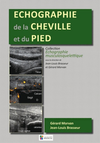 Jean-Louis Brasseur et Gérard Morvan - Echographie de la cheville et du pied.