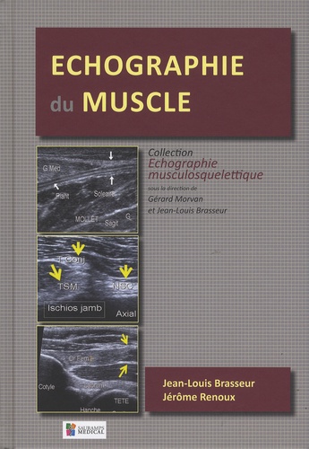 Jean-Louis Brasseur et Jérôme Renoux - Echographie du muscle.