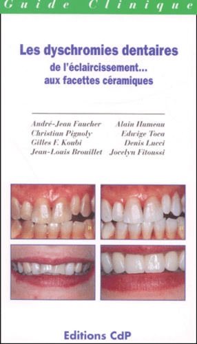 Jean-Louis Brouillet et André-Jean Faucher - Les Dyschromies Dentaires : De L'Eclaircissement... Aux Facettes Ceramiques.