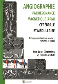 Jean-Louis Dietemann et Pascale Anstett - Angiographie par résonance magnétique (ARM) cérébrale et médullaire - Techniques, indications, résultats, variantes et pièges.