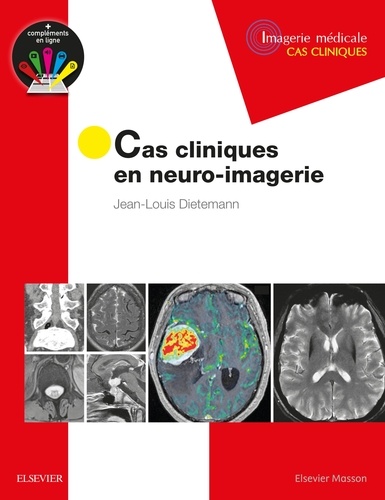 Jean-Louis Dietemann - Cas cliniques en neuro-imagerie.