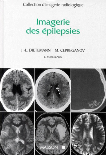 Jean-Louis Dietemann et  Cepreganov - Imagerie des épilepsies.