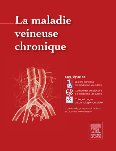 Jean-Louis Guilmot et Claudine Hamel-Desnos - La maladie veineuse chronique.