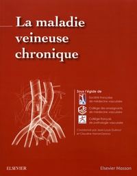 La maladie veineuse chronique.pdf