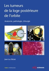 Jean-Luc Béziat - Les tumeurs de la loge postérieure de l'orbite - Tome 2, Pathologie.
