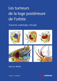 Jean-Luc Béziat - Les tumeurs de la loge postérieure de l'orbite - Tome 3, Chirurgie.