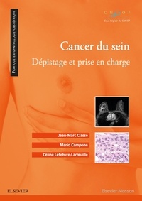 Jean-Marc Classe et Mario Campone - Cancer du sein - Dépistage et prise en charge.
