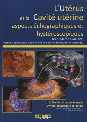 Jean-Marc Levaillant - L'utérus et la cavité utérine - Aspects échographiques et hystéroscopiques.