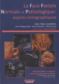 Jean-Marc Levaillant - La face foetale normale et pathologique : aspects échographiques.