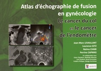 Jean-Marc Levaillant et Laurence Gitz - Le cancer du col et le cancer de l'endomètre - Atlas d'échographie fusion en gynécologie.