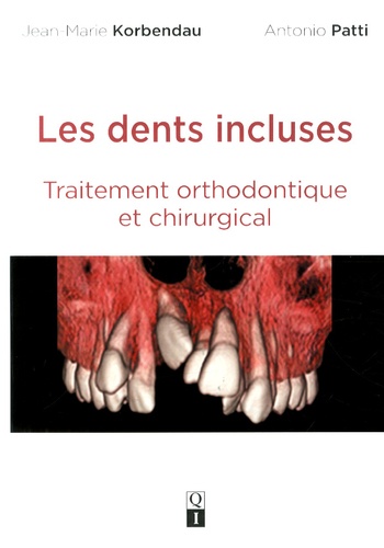 Jean-Marie Korbendau et Antonio Patti - Les dents incluses - Traitement orthodontique et chirurgical.