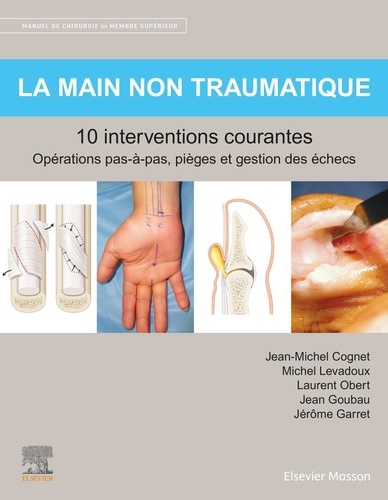 La main non traumatique. 10 interventions courantes