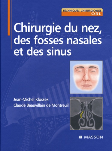 Jean-Michel Klossek et  Beauvillain - Chirurgie du nez, des fosses nasales et des sinus.