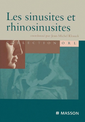Jean-Michel Klossek - Les Sinusites Et Les Rhinosinusites.