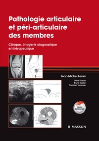 Jean-Michel Lerais - Pathologie articulaire et péri-articulaire des membres - Clinique, imagerie diagnostique et thérapeutique.