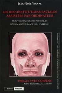 Jean-noël Vignal - Les Reconstitutions Faciales Assistées Par Ordinateur - Données tomodensitométriques, déformation d'image ou "warping".