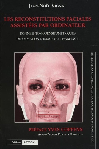 Jean-noël Vignal - Les Reconstitutions Faciales Assistées Par Ordinateur - Données tomodensitométriques, déformation d'image ou "warping".