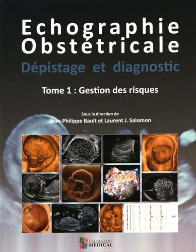 Jean-Philippe Bault et Laurent J. Salomon - Echographie obstétricale, dépistage et diagnostic - Tome 1, Gestion des risques.
