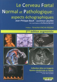 Jean-Philippe Bault et Laurence Loeuillet - Le cerveau foetal normal et pathologique : aspects échographiques.