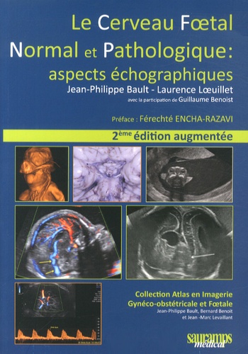 Jean-Philippe Bault et Laurence Loeuillet - Le cerveau foetal normal et pathologique : aspects échographiques.
