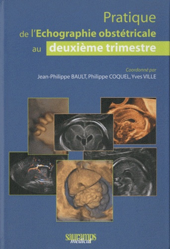 Jean-Philippe Bault et Philippe Coquel - Pratique de l'échographie obstétricale au 2e trimestre.