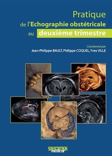Jean-Philippe Bault et Philippe Coquel - Pratique de l'échographie obstétricale au 2e trimestre.