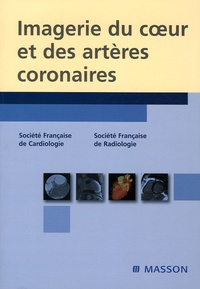 Jean-Pierre Laissy et Pascal Guéret - Imagerie du coeur et des artères coronaires.
