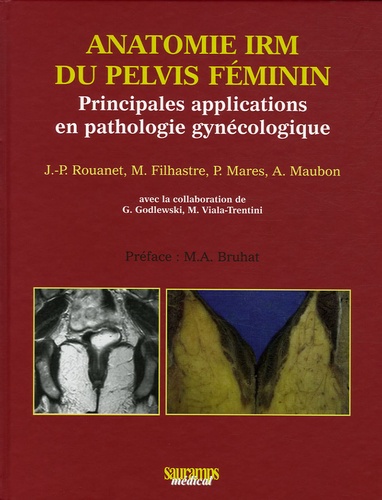 Jean-Pierre Rouanet de Lavit et M Filhastre - Anatomie IRM du pelvis féminin - Principales applications en pathologie gynécologique.
