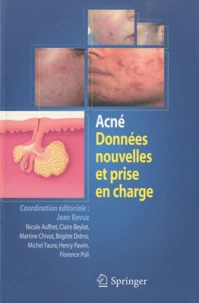 Acné