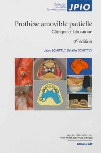 Jean Schittly et Estelle Schittly - Prothèse amovible partielle - Clinique et laboratoire.