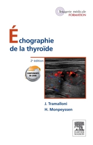 Echographie de la thyroïde 2e édition