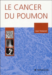 Jean Trédaniel - Le cancer du poumon.