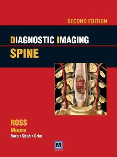 Jeffrey S. Ross et Kevin R. Moore - Diagnostic Imaging: Spine.