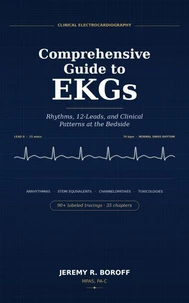 Comprehensive Guide to EKG's  Rhythms, 12 leads, and Clinical Patterns at Bedside