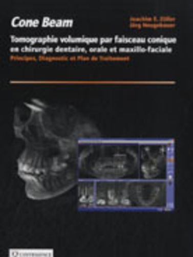 Cone Beam Tomographie Volumique Par Faisceau Conique En Chirurgie Dentaire Orale Et Maxillo Faciale Principes Diagnostic Et Plan De Traitement -