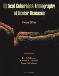 Joel S Schuman - Optical Coherence Tomography of Ocular Diseases.